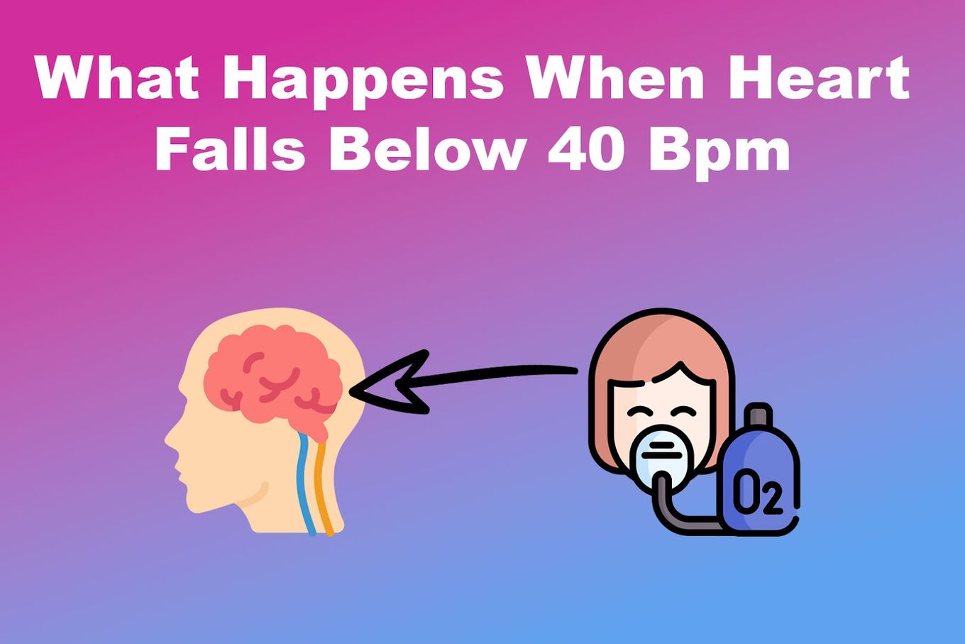 What Happens When Heart Falls Below 40 Bpm
