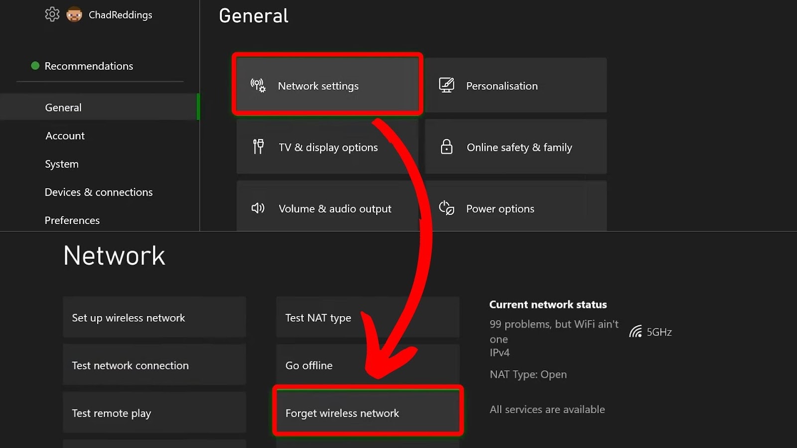 Accessing Xbox Console Network Settings